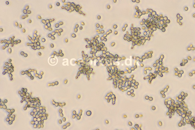 Sukkersvamp. Celler af g�r set i mikroskop; Saccharomyces cerevisiae ; ; ; ; svampe; G�rsvampe, Endomycetales, bageg�r, h�vemiddel