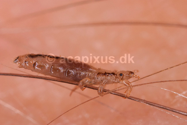 Hovedlus. Hoved lus - hunlus - blodsugende insekt - reprocessing af KOL10889; Pediculus humanus capitis; ; ; ; insekter; Egentlige lus, Siphunculata, ut�j, skadedyr, h�r, hovedbund, plettyfus, blodsugere, snyltere, snyltedyr
