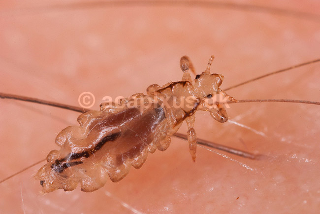 Hovedlus. Hoved lus - hunlus - blodsugende insekt - reprocessing af KOL10890; Pediculus humanus capitis; ; ; ; insekter; Egentlige lus, Siphunculata, ut�j, skadedyr, h�r, hovedbund, plettyfus, blodsugere, snyltere, snyltedyr