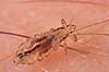 Hovedlus. Hoved lus - hunlus - blodsugende insekt - reprocessing af KOL10890 Pediculus humanus capitis    insekter Egentlige lus, Siphunculata, ut�j, skadedyr, h�r, hovedbund, plettyfus, blodsugere, snyltere, snyltedyr