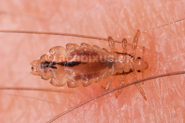 Hovedlus. Hoved lus - hunlus - blodsugende insekt - reprocessing af KOL10891; Pediculus humanus capitis; ; ; ; insekter; Egentlige lus, Siphunculata, ut�j, skadedyr, h�r, hovedbund, plettyfus, blodsugere, snyltere, snyltedyr